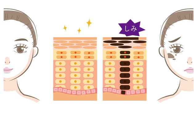 肌のターンオーバー
