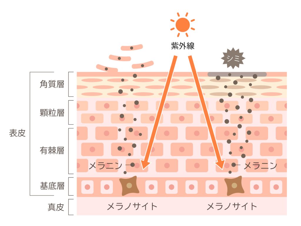 シミが出来るまでの肌の断面図